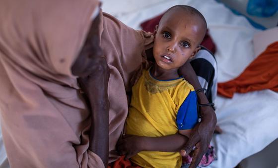 La emaciación infantil se puede prevenir con inversiones adecuadas