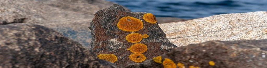 Endometriosis extrapélvica