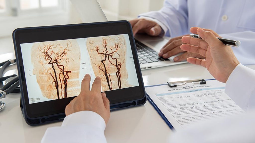 La Síndica de Greuges investiga la falta de atención 24 horas para el ictus en Lleida y Tarragona