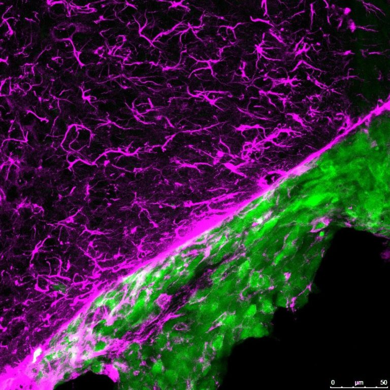 Manuel Vicente, investigador: "Urge encontrar terapias específicas para la metástasis cerebral"