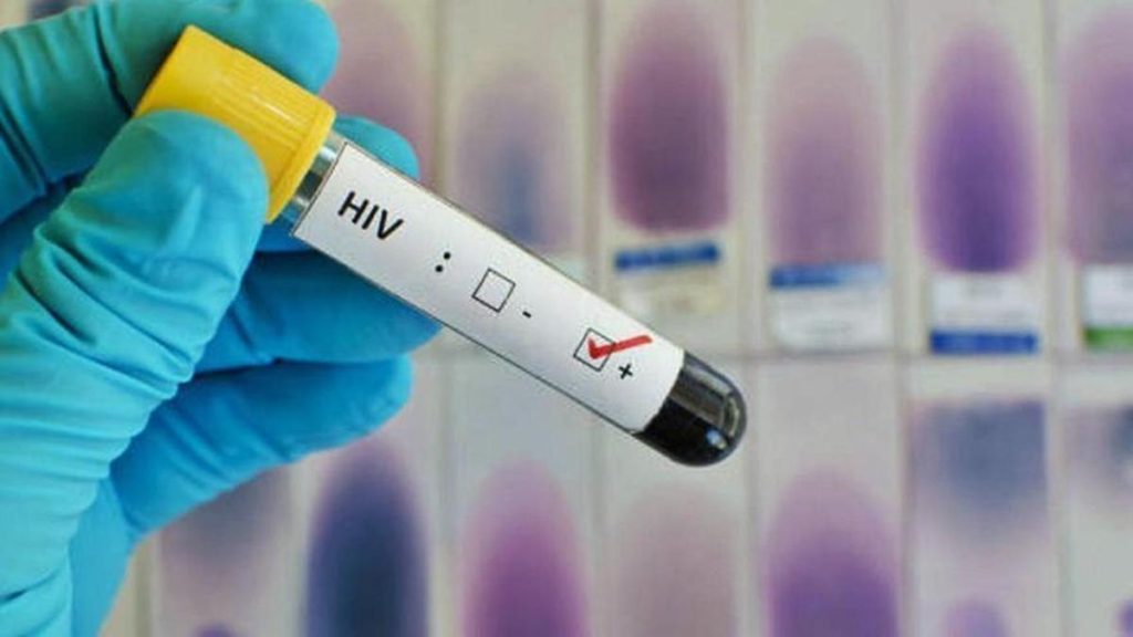 Un estudio muestra el potencial de combinar la vacuna contra el VIH con un fármaco para mejorar la respuesta frente al virus