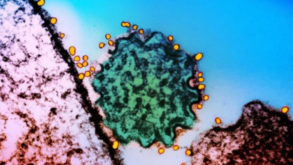 Alerta en la India por el brote del virus Nipah, que la OMS vigila porque puede provocar una pandemia