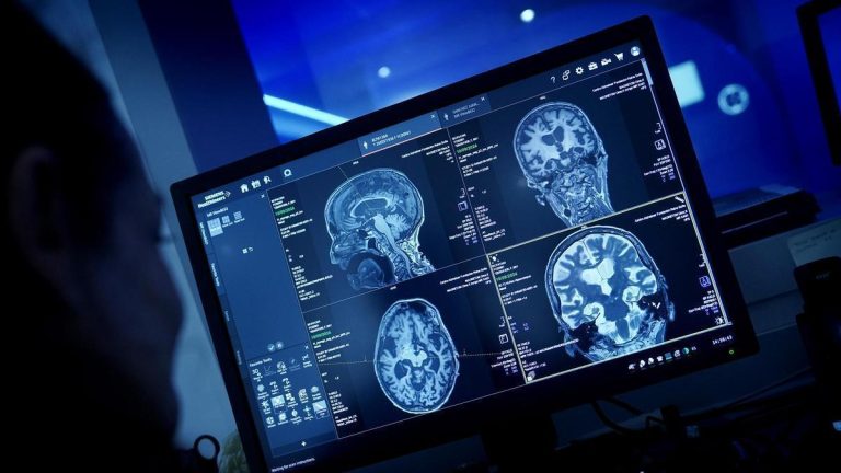 Más de la mitad de las comunidades ya ofrecen en la sanidad pública una innovadora terapia para el tumor cerebral más agresivo y de peor pronóstico