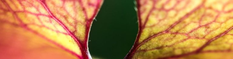 Telangiectasia hemorrágica hereditaria (Rendu-Osler-Weber)