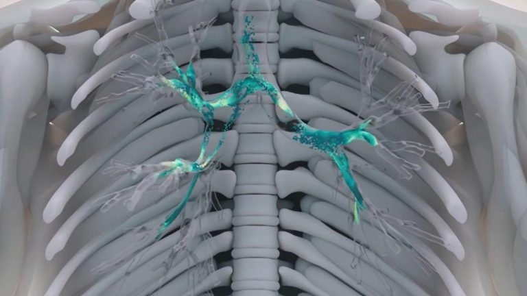 El cáncer de pulmón es el tumor más letal entre mujeres españolas con más de 6.800 muertes al año